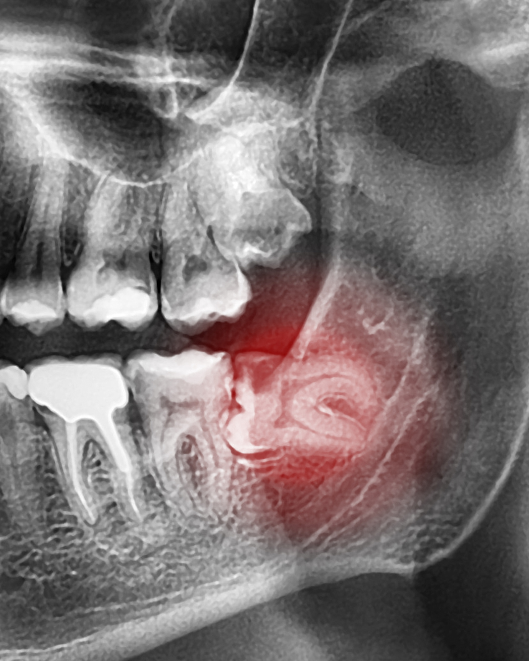 Kembla St Dental - Services Images 1 - Kembla St Dental